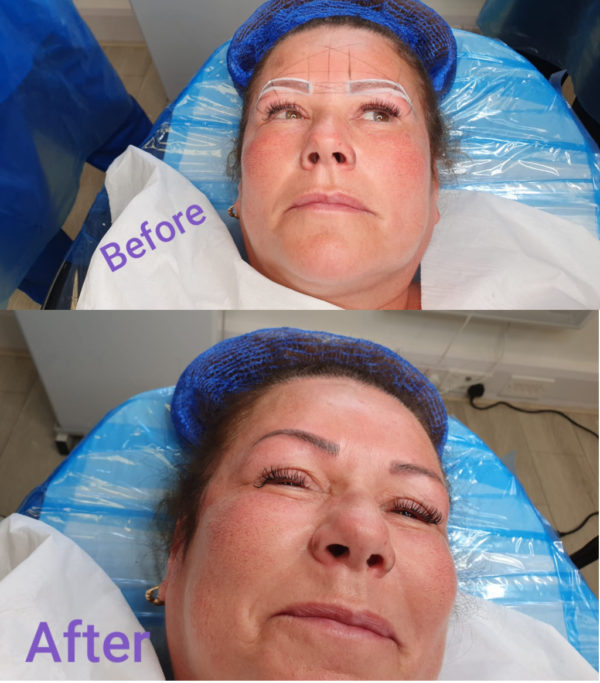 Birmingham Microblading before and after 