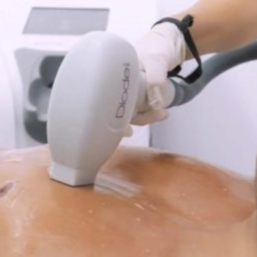 Laser Hair Removal FAQ in Birmingham Vogue Beauty and Aesthetics